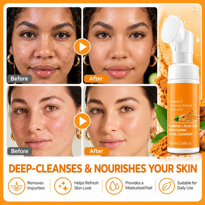 Turmeric Facial Cleansing Mousse – Foaming Face Wash for Daily Cleansing & Hydration